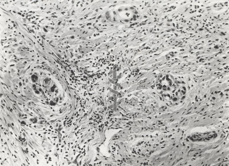 Studio istologico di una cellula argentaffine (struttura che si colora con i sali d'argento) dell'appendice