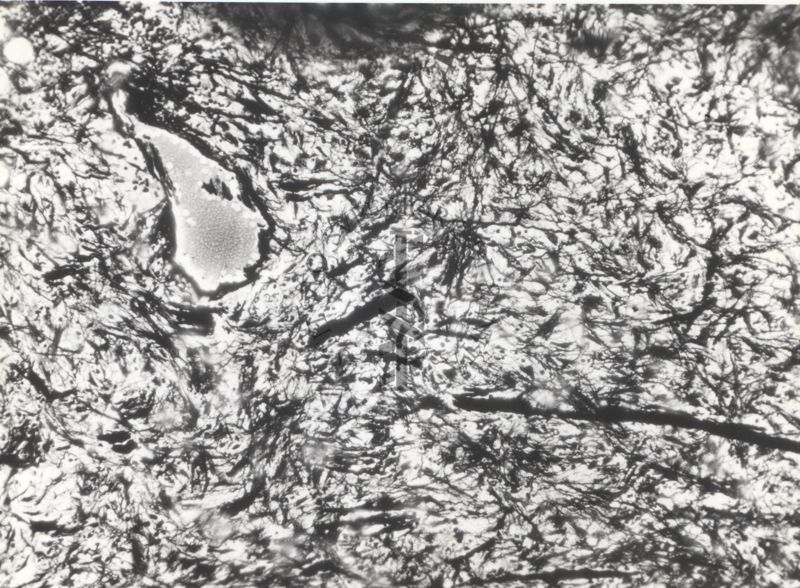 Studio istologico di una cellula argentaffine (struttura che si colora con i sali d'argento) dell'appendice