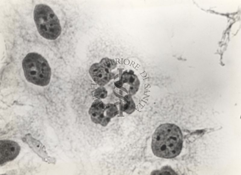 Cellula tipo "H" da coltura in vitro del ceppo KB.