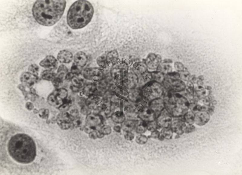 Cellula tipo "H" da coltura in vitro del ceppo KB.