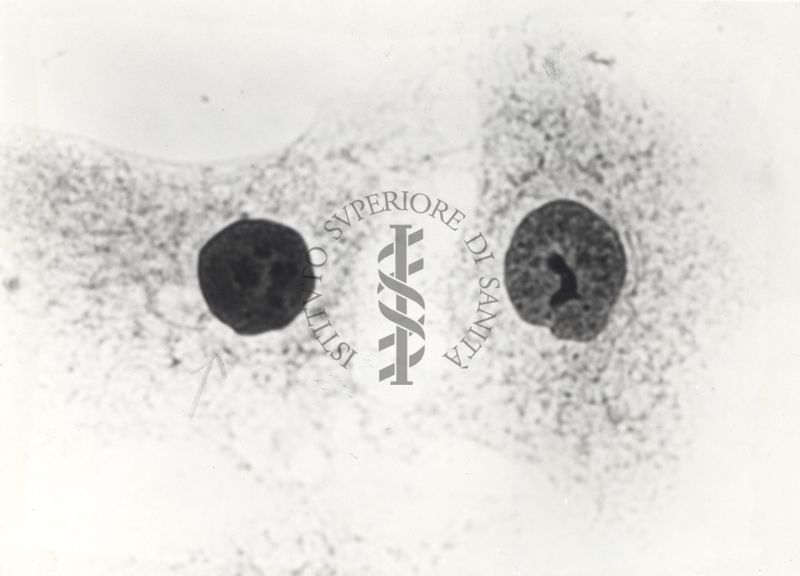 Cellula tipo "A1" da coltura in vitro del ceppo KB.