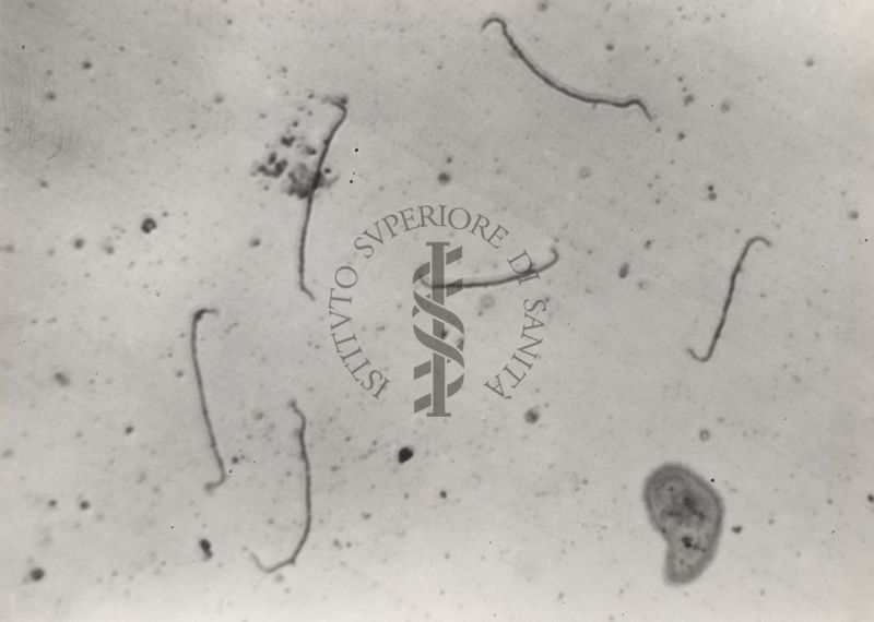 La Leptospirosi. Infezione causata da uno dei diversi sierotipi patogeni della "The Spirochete Leptospira".