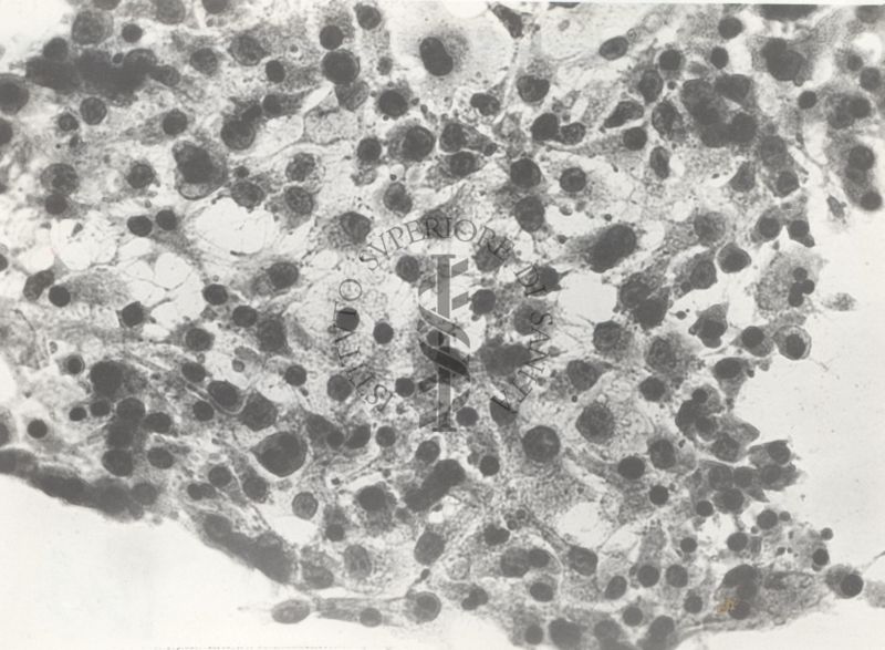 Tossina Clostridium septicum mg. 0,005/ml dopo 3 ore. Cellule del fegato.