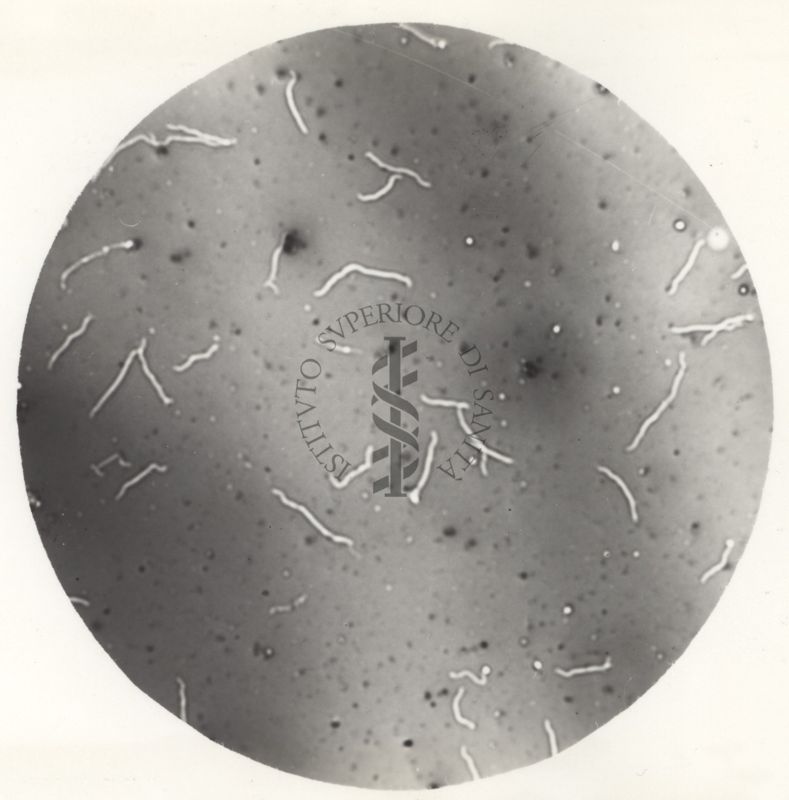 La leptospira è un genere di batteri appartenente al "phylum Spirochaetes". Ha la forma di filamento elicoidale ad estremità uncinate e possiede 2 flagelli che lo rendono mobile.