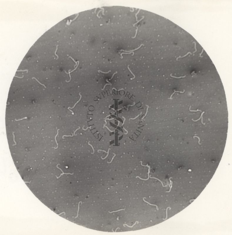 La leptospira è un genere di batteri appartenente al "phylum Spirochaetes". Ha la forma di filamento elicoidale ad estremità uncinate e possiede 2 flagelli che lo rendono mobile.