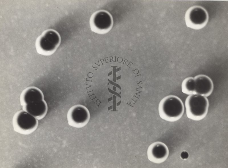 Fotografie di Corynebacterium diphtheriae