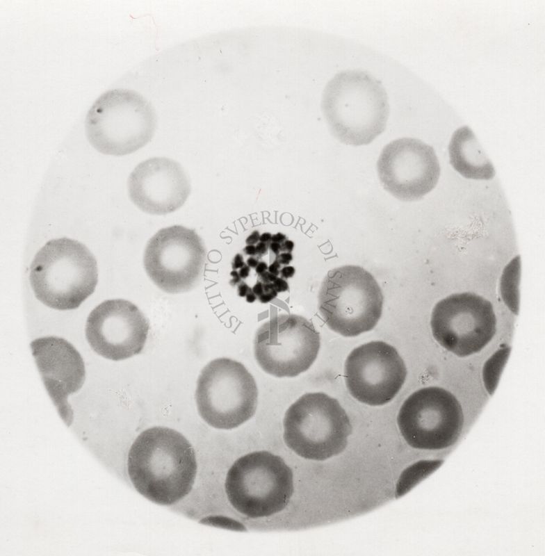 Rosetta di Plasmodium vivax