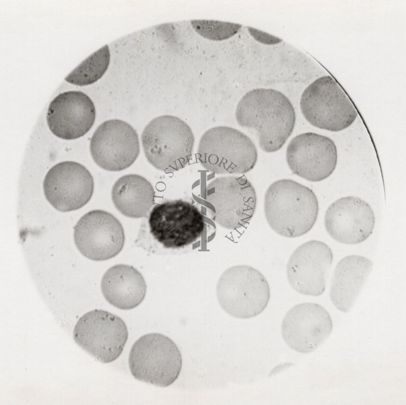 Microgametocito maturo di Plasmodium vivax
