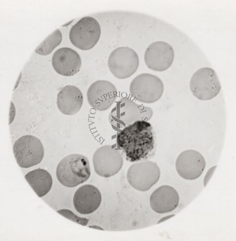 Macrogametocito maturo di Plasmodium vivax