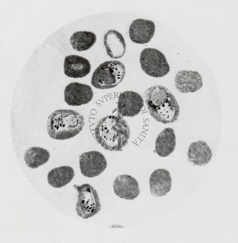 Parassiti della malaria (terzana)