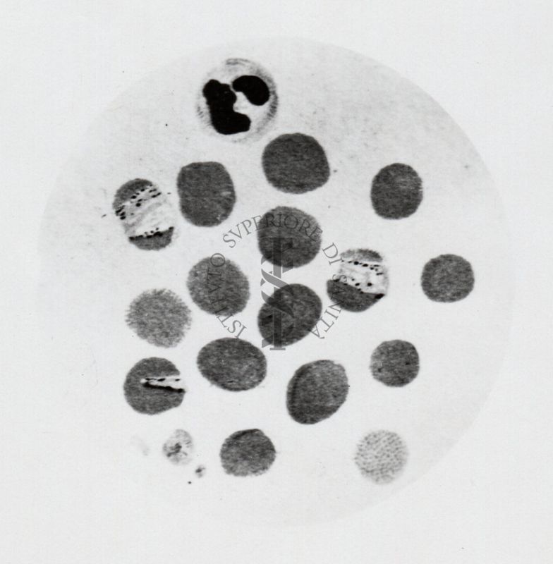 Parassiti della malaria (quartana).