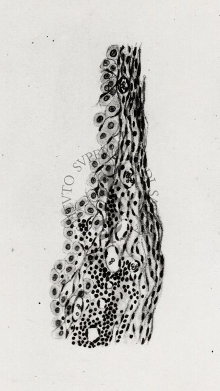 Membrana cistica in un caso di infestazione epatica da cysticercus fasciolaris
