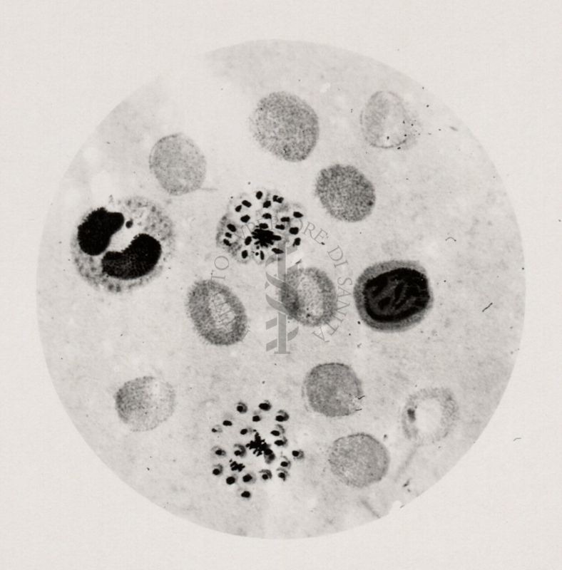 Plasmodium vivax ovvero forma a rosetta