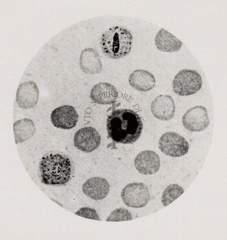 Schizonti di Plasmodium vivax