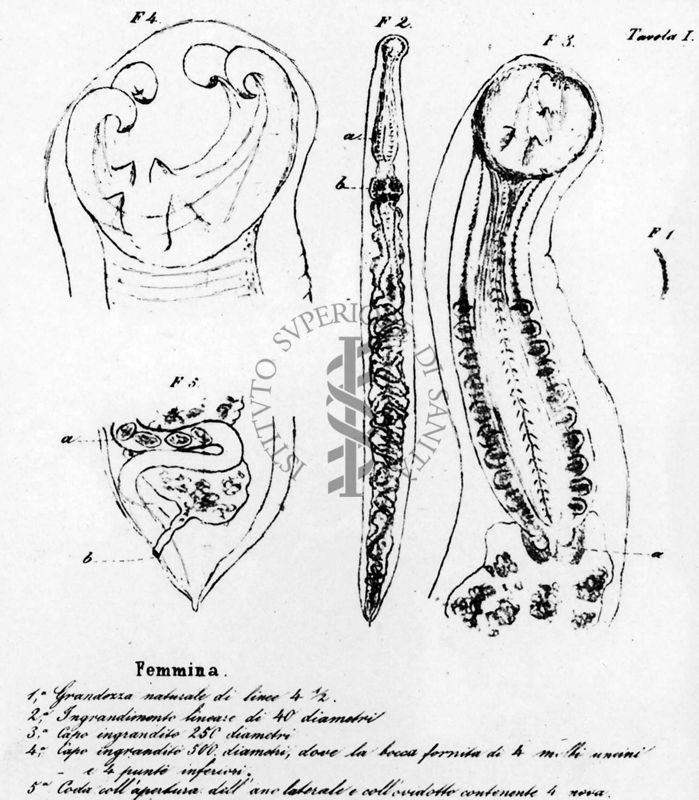 Lavoro e tavole originali di Angelo Dubini sull'Anchilostoma 1843