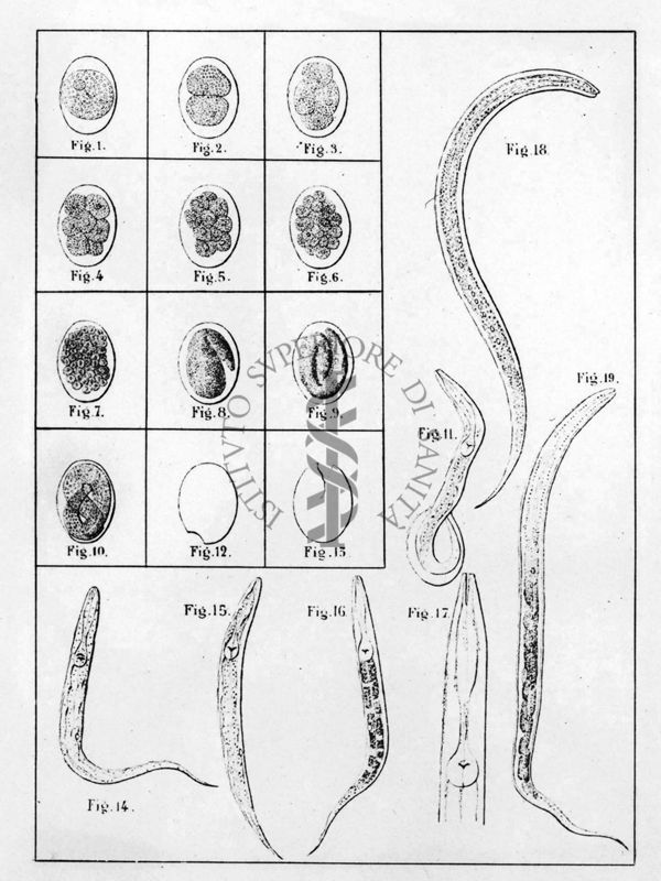 "la malattia dei minatori" Tavole annesse al volume originale di E. Peroncito