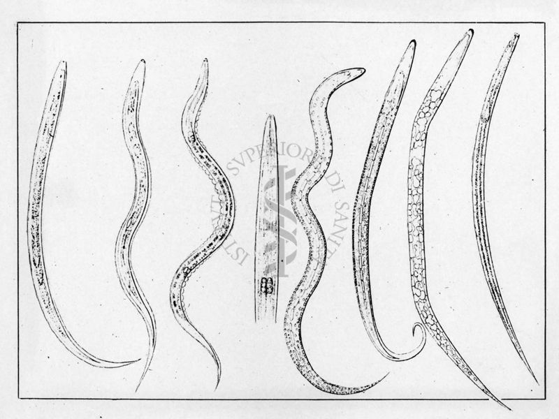 "La malattia dei minatori" Tavole annesse al volume originale di E. Peroncito