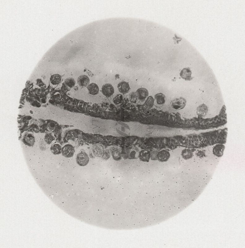 Sezione longitudinale di stomaco di Anopheles parassitato