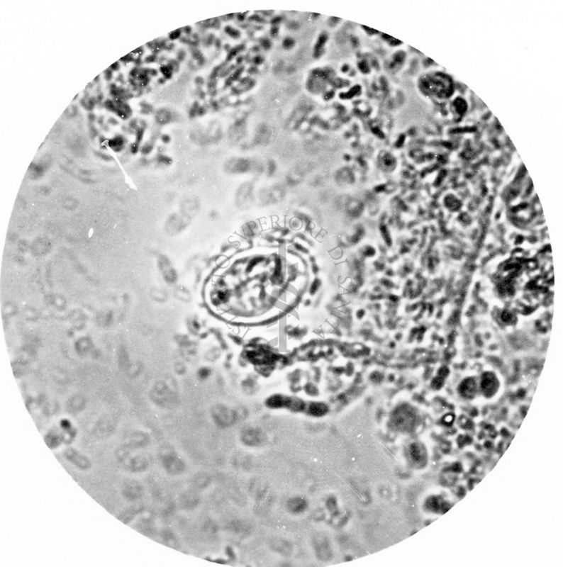 Giardia intestinale - cisti