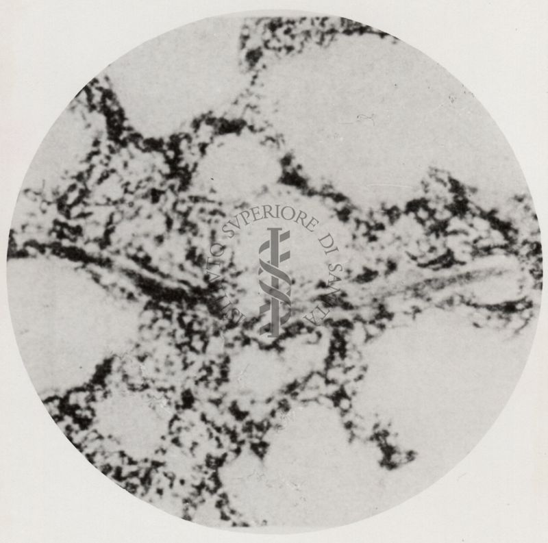 Larva di Anchylostoma in un capillare polmonare
