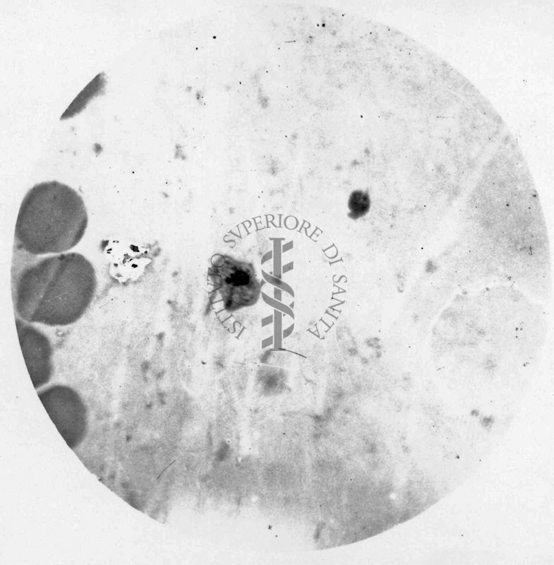 Trypanosoma gambiense - forma a girino di rana