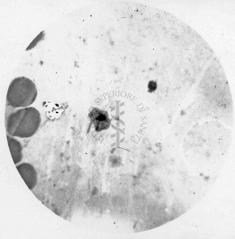 Trypanosoma gambiense - forma a girino di rana