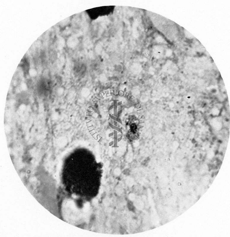 Trypanosoma gambiense - forma a Leishmania