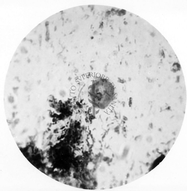 Trypanosoma gambiense - forma a Leishmania