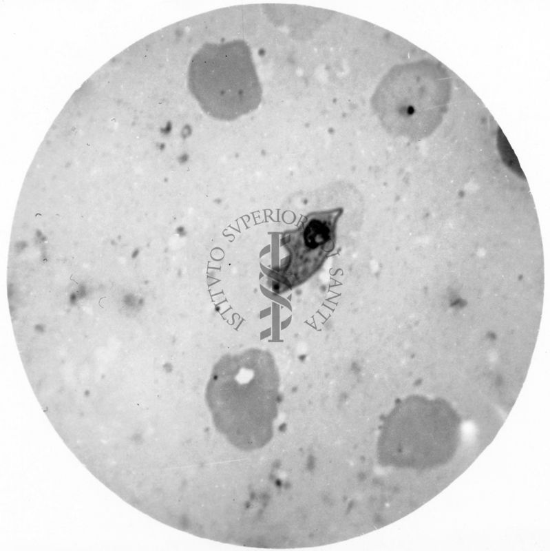 Trypanosoma gambiense - forme involute