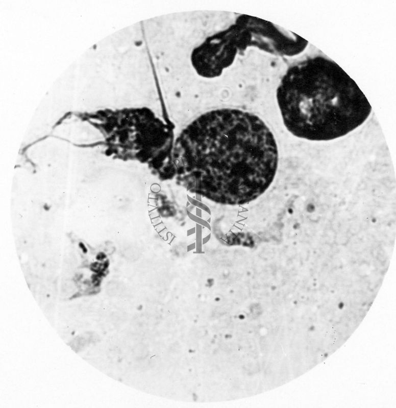 Trypanosoma gambiense - forme in distruzione