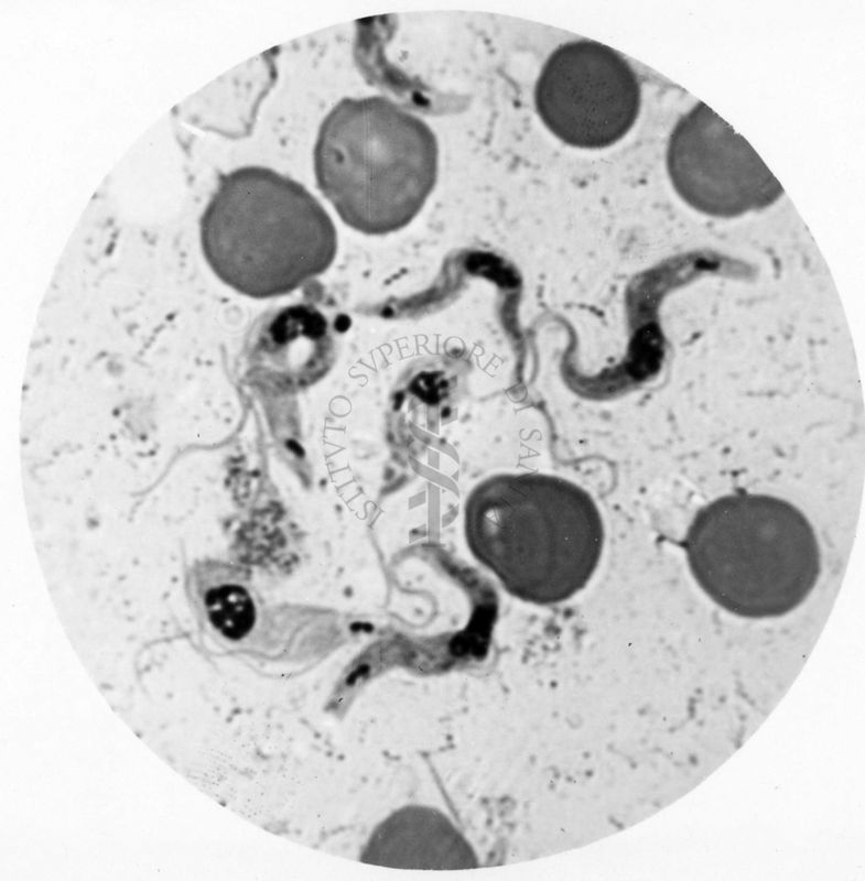 Trypanosoma gambiense - forme tipo B in fase di Crithidia