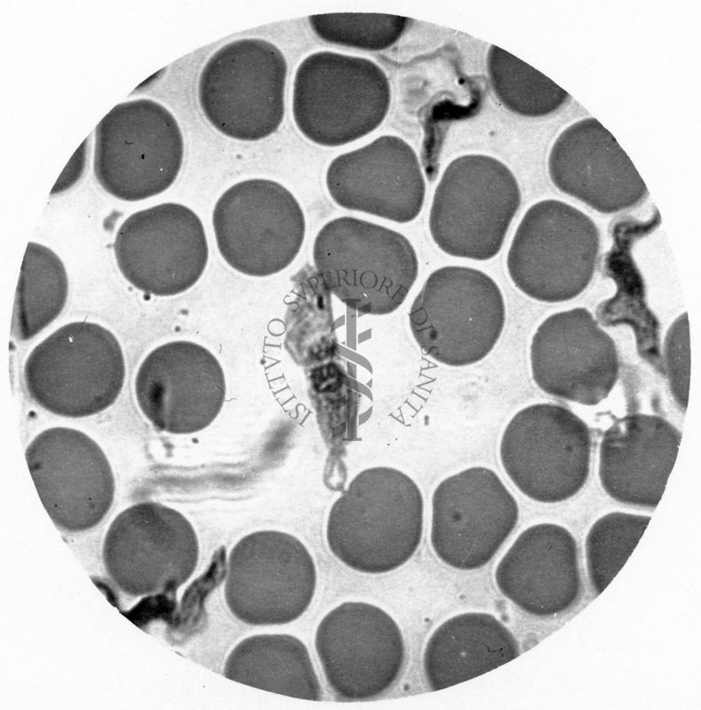 Trypanosoma gambiense - forma tipo B.