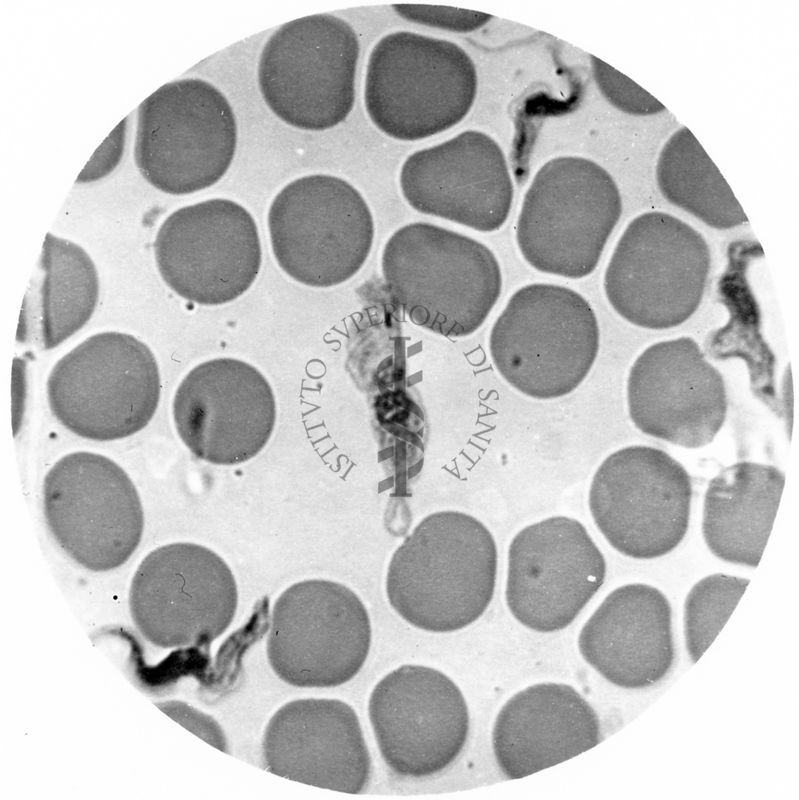 Trypanosoma gambiense - forma tipo B.