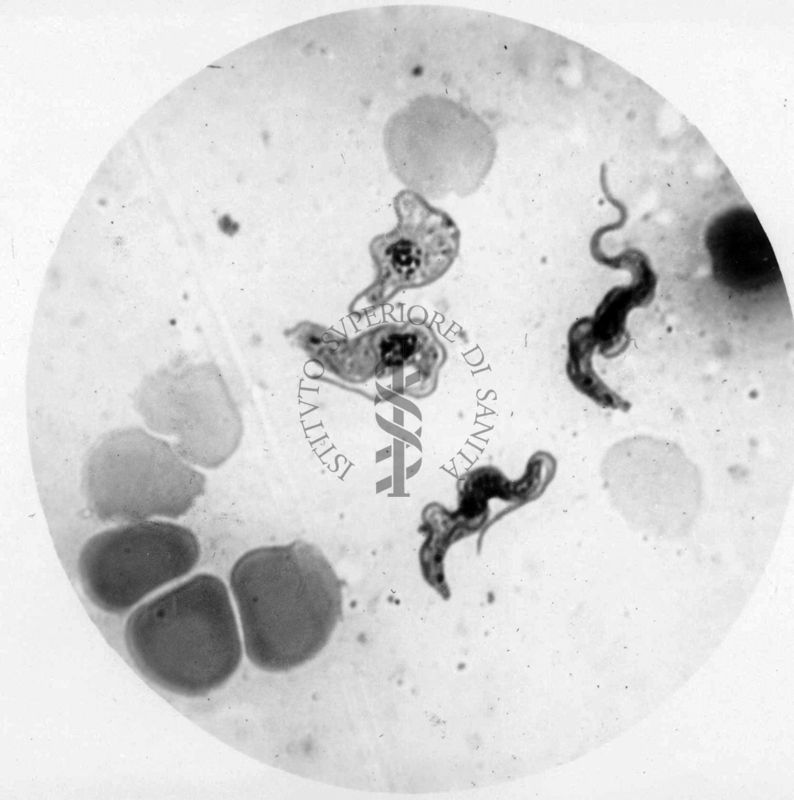 Trypanosoma gambiense - forme tipo A. e B.