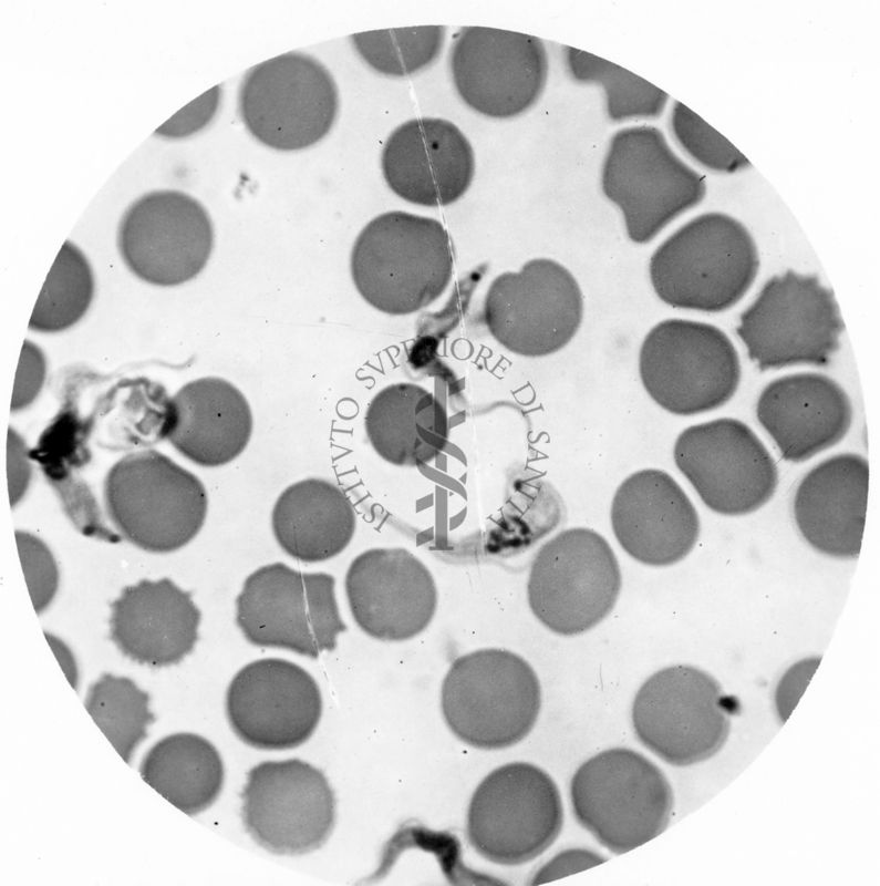 Trypanosoma gambiense - forme tipo B elelmenti maschili