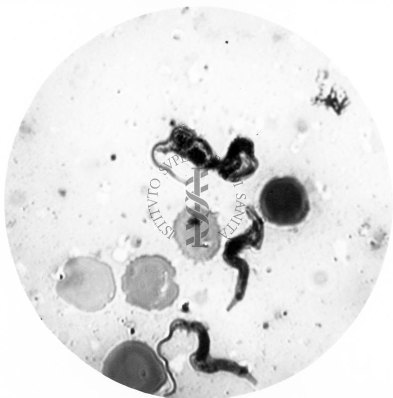 Trypanosoma gambiense - forma tipo A e tipo B in propabile singamia