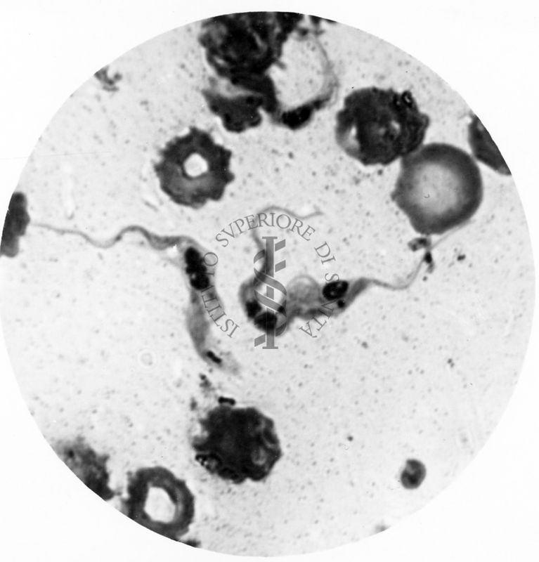 Trypanosoma gambiense - forma tipo A e tipo B in propabile singamia