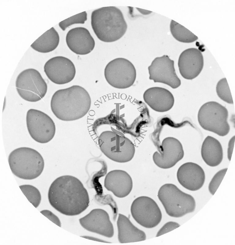 Trypanosoma gambiense - forma tipo A e tipo B in propabile singamia