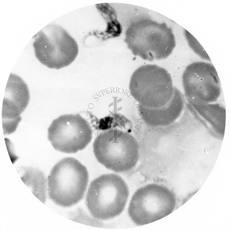 Trypanosoma gambiense - forma a Endotrypanum libera in circolo