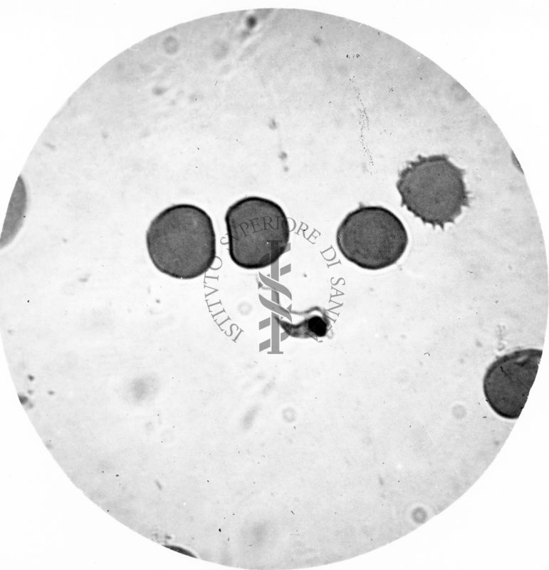 Trypanosoma gambiense - forma a Crithidia con etremità posteriore aguzza