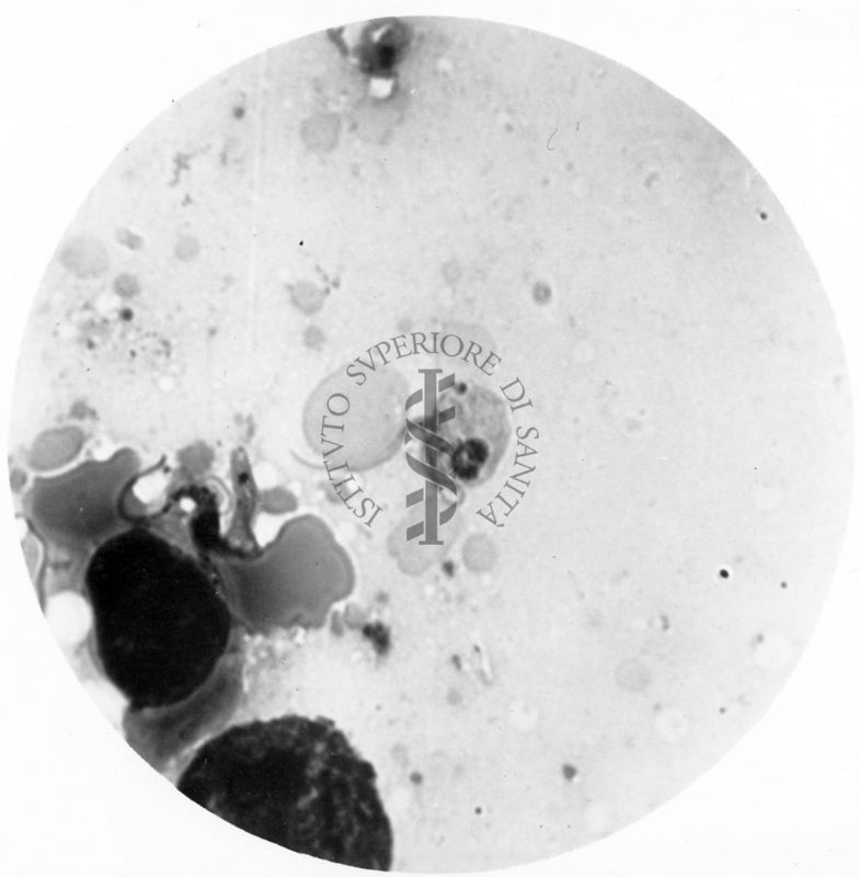 Trypanosoma gambiense - forma a Crithidia evolventi verso la fase a leptomonas