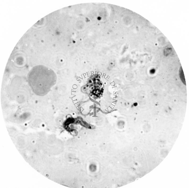 Trypanosoma gambiense - forma a Crithidia evolventi verso la fase a leptomonas