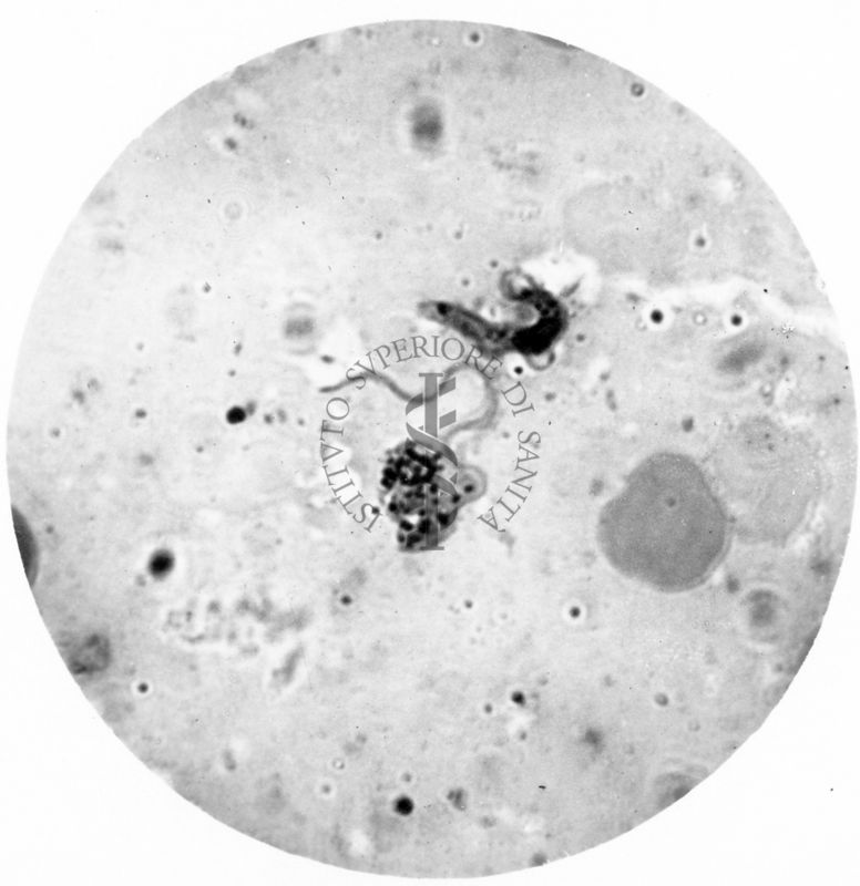 Trypanosoma gambiense - forme a Crithidia evolventi verso la fase a leptomonas