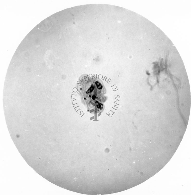 Trypanosoma gambiense - grossa forma a Leptomonas  in divisione multipla (forma a rosetta)