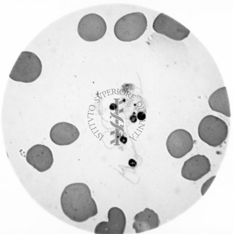 Trypanosoma gambiense - forme a Leptomonas  prodotte, evidentemente, dalla divisione multipla forma a rosetta