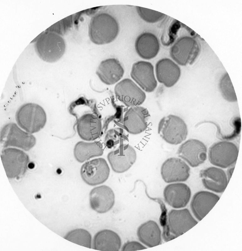 Trypanosoma gambiense - forma a Leishmania nel sangue circolante