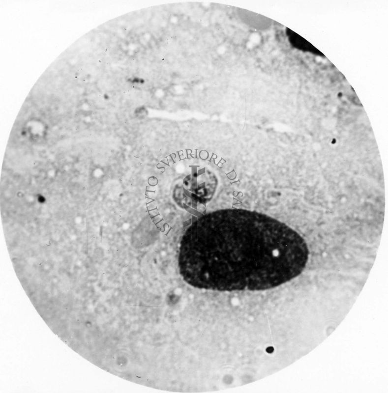 Trypanosoma gambiense - forma a Leishmania in divisione binaria: i blefaroblasti si sono già separati