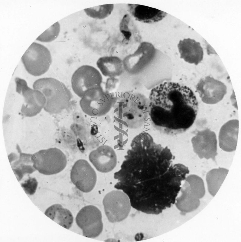 Trypanosoma gambiense - forme a Leishmania in divisione multipla