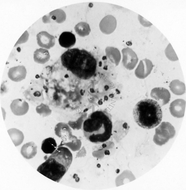 Trypanosoma gambiense - forme a Leishmania in divisione multipla