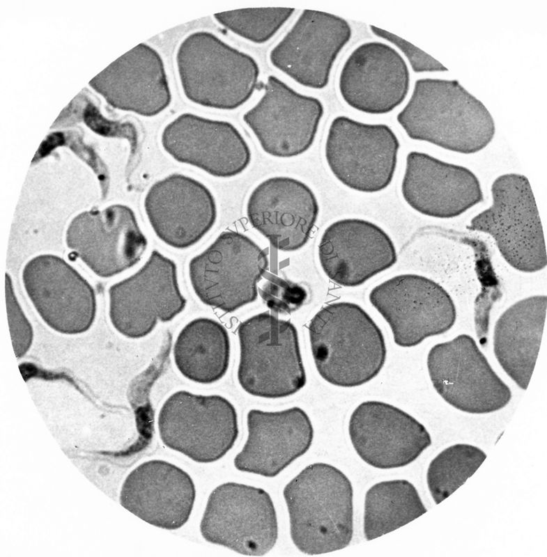 Trypanosoma gambiense - forme postleishmaniche